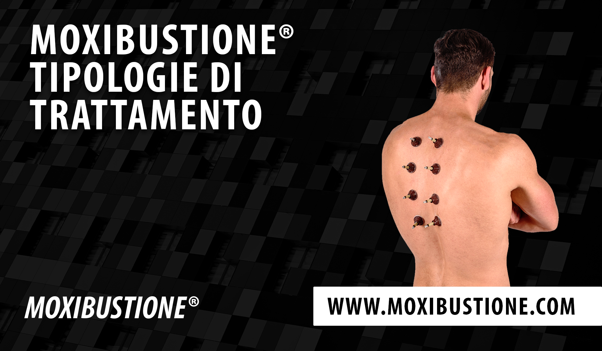 Tipologie di Moxibustione