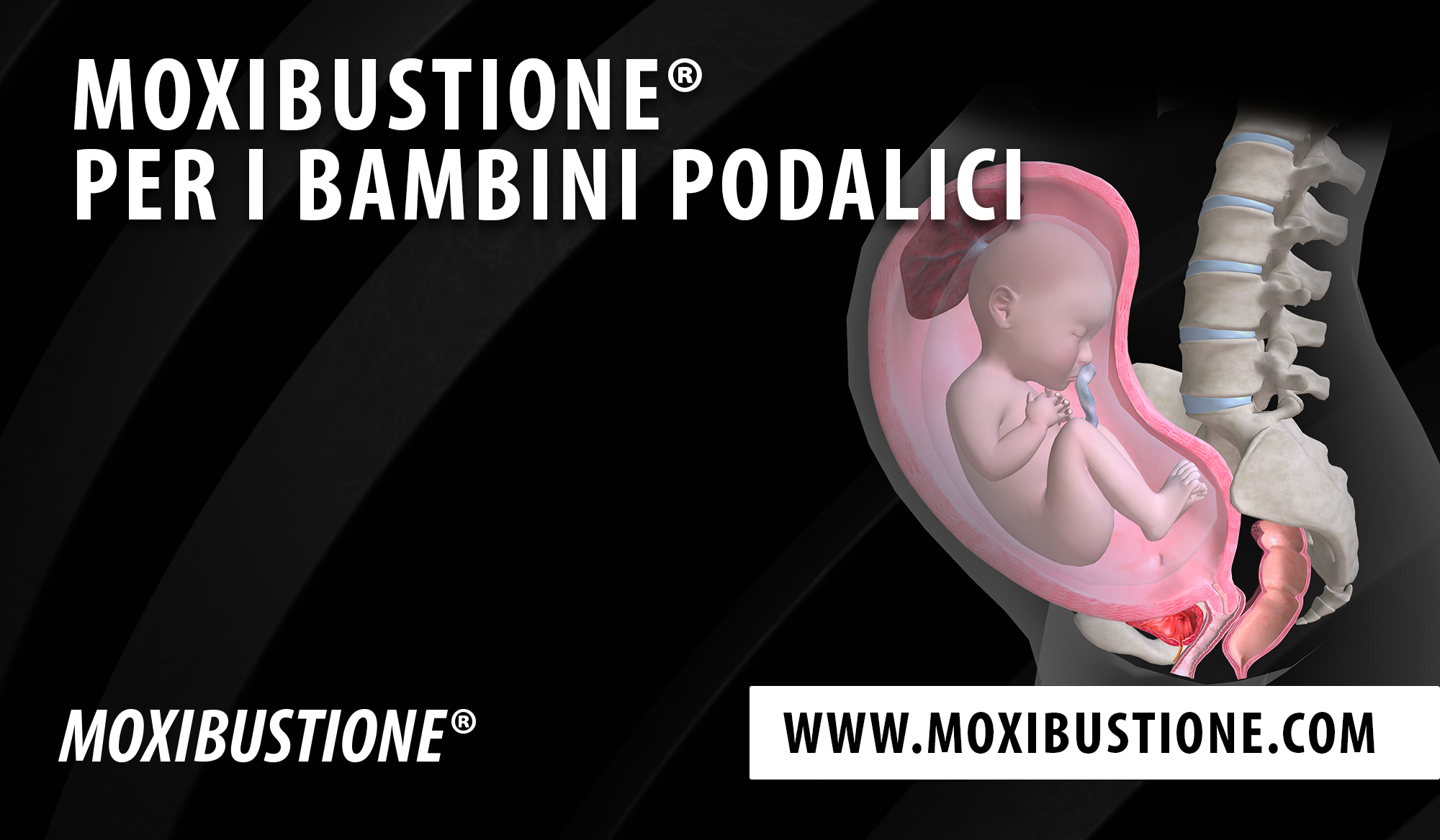 Moxibustione per i bambini podalici